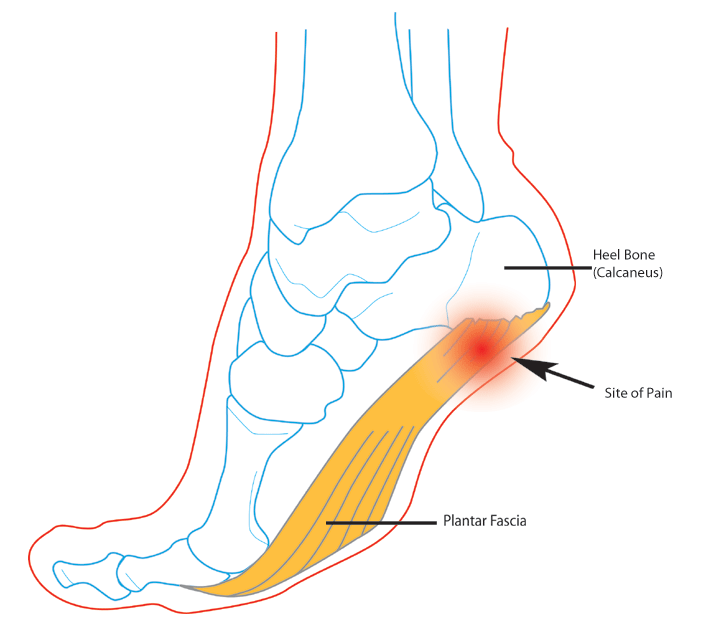 heel pain after sitting